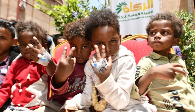 توزيع كسوة العيد لـ ثلاثة آلاف و 546 طفل من مرضى الثلاسيميا بالتنسيق مع الجمعية اليمنية لمرضى الثلاسيميا بمناسبة عيد الأضحى الهيئة العامة للزكاة